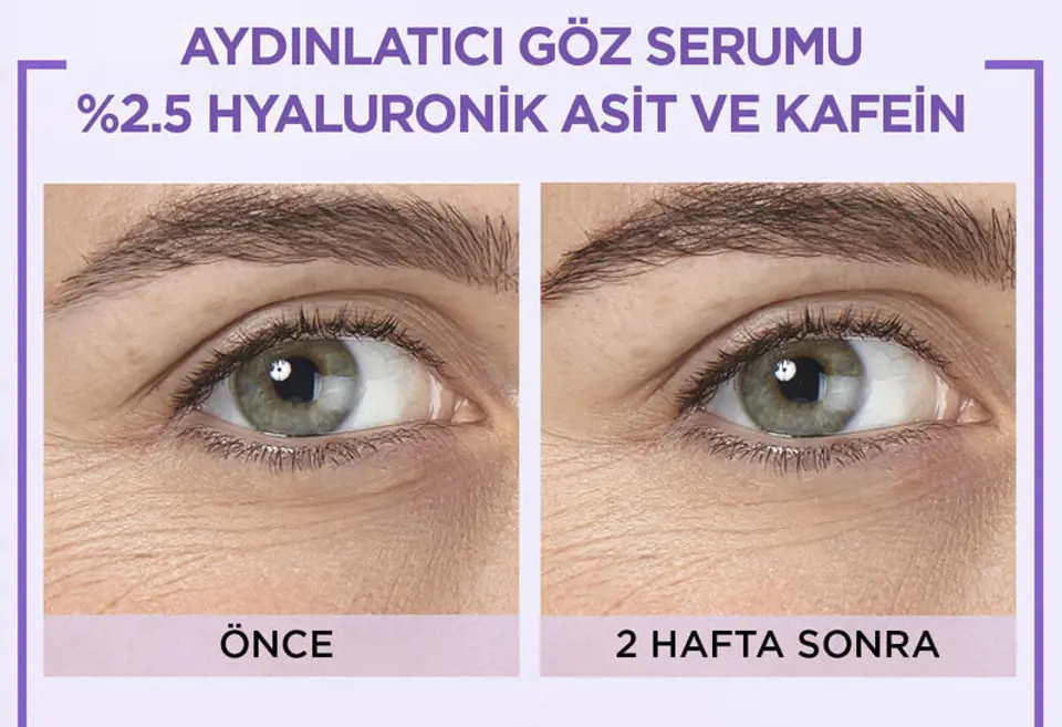 L’Oréal Paris Revitalift Filler Aydınlatıcı Göz Serumu Özellikleri